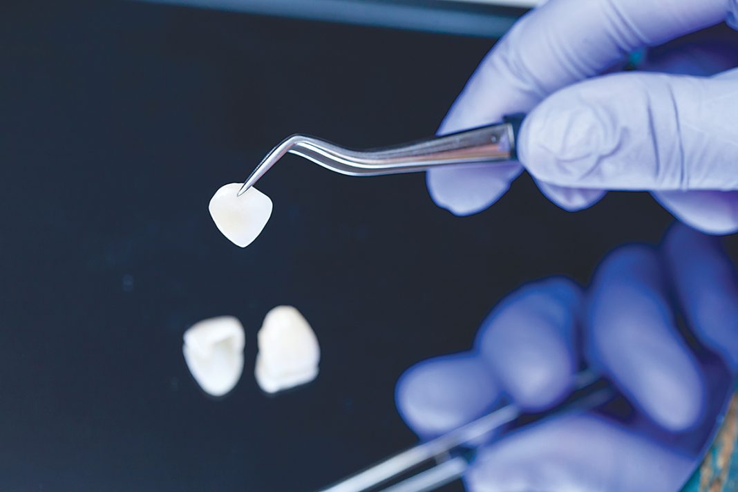 The tribology of dental ceramics Thermal Processing Magazine